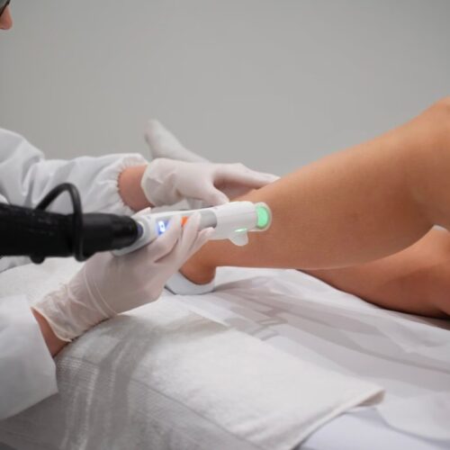 Épilation laser médicale